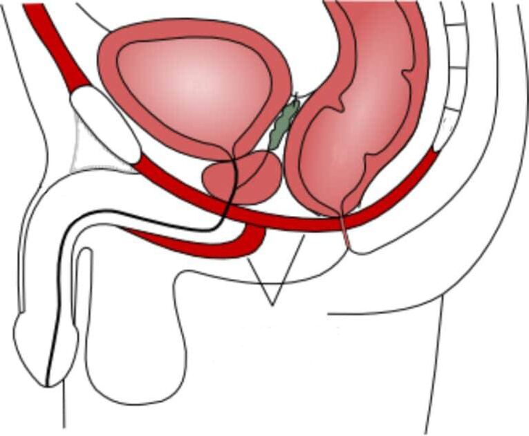training the pelvic floor muscles to improve potency